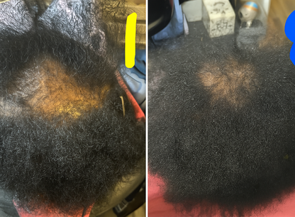 Balmify Root Restore Cream