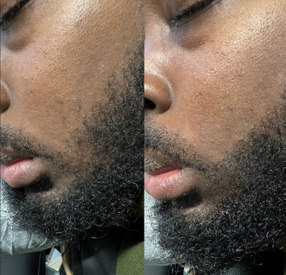 Balmify Root Restore Cream