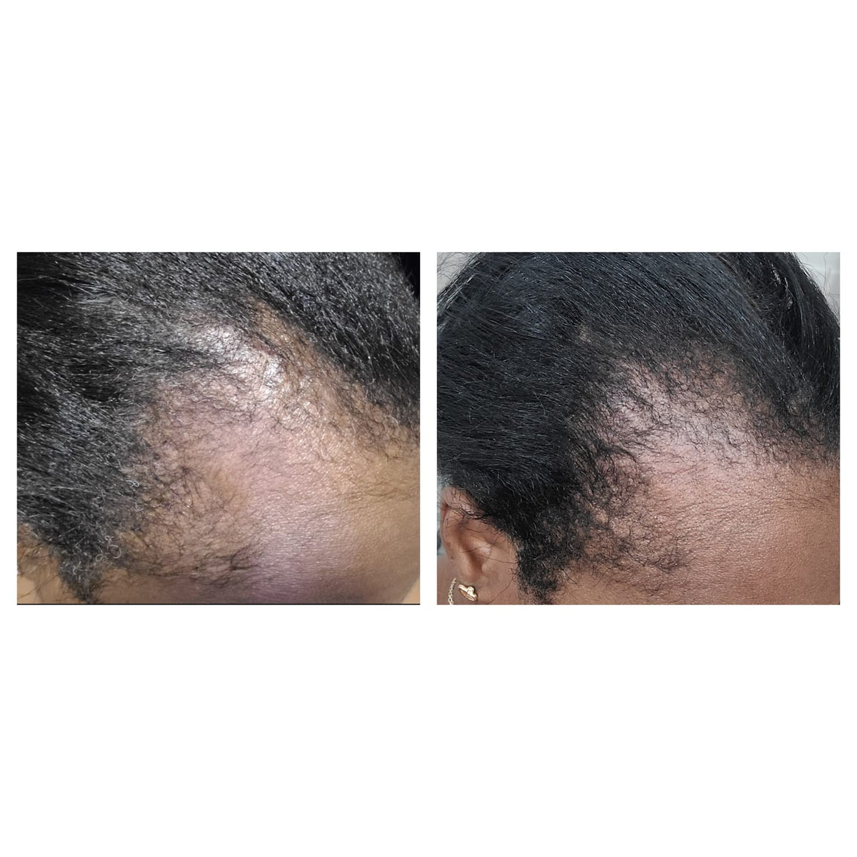 Balmify Root Restore Cream