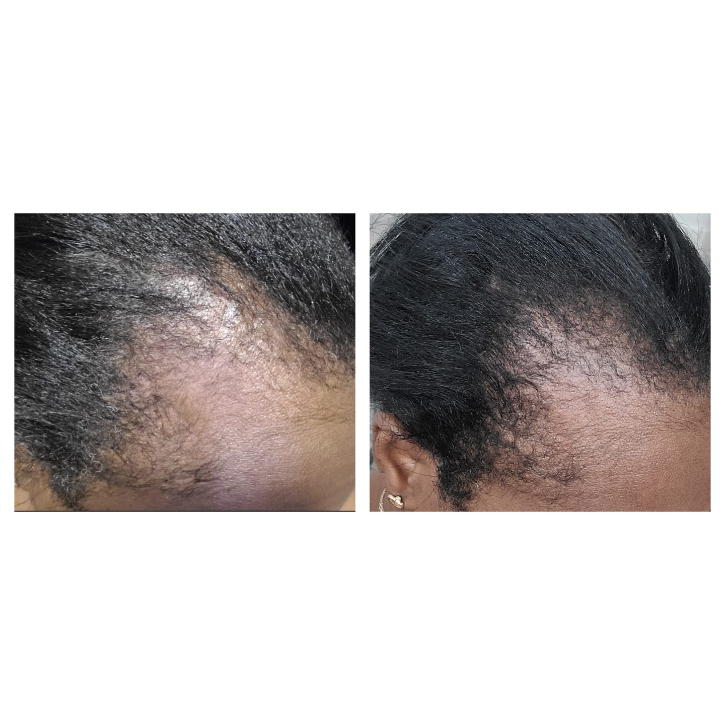 Balmify Root Restore Cream