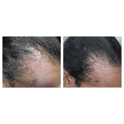 Balmify Root Restore Cream