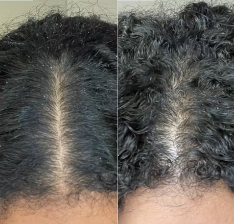 Balmify Root Restore Cream