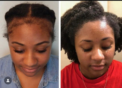 Balmify Root Restore Cream