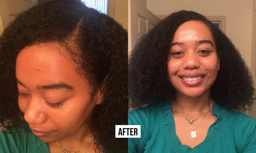 Balmify Root Restore Cream