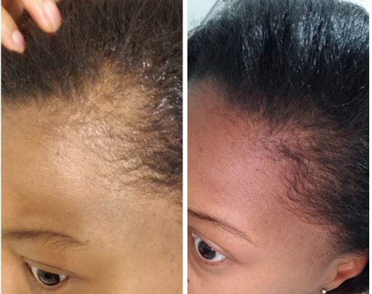 Balmify Root Restore Cream