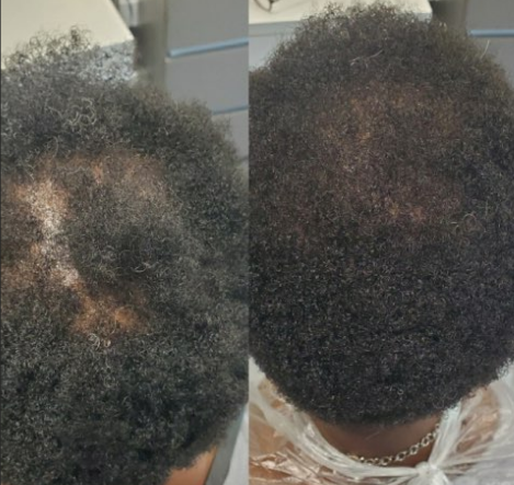 Balmify Root Restore Cream