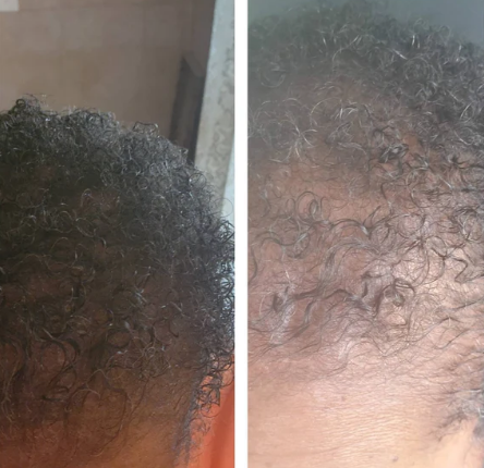 Balmify Root Restore Cream